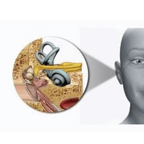 3 طرق لعلاج التهاب الأذن الداخلية وعلاقتها بمشاكل الاتزان