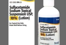 دواء سلفاسيتاميد Sulfacetamide دواعي الاستعمال والآثار الجانبية