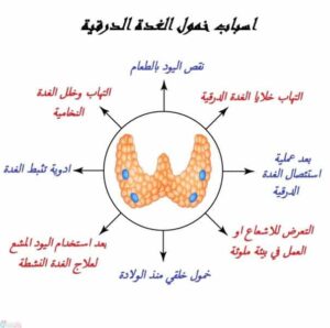 3 طرق فعالة لعلاج خمول الغدة الدرقية خلال أسبوع فقط