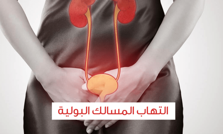 5 عوامل خطر لالتهاب المسالك البولية وعلاجها والوقاية منه