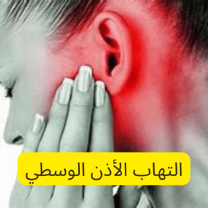 3 طرق لعلاج التهاب الأذن الوسطي والوقاية منها عند الأطفال