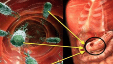 التخلص من جرثومة المعدة نهائياً خلال 3 أسابيع