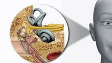 3 طرق لعلاج التهاب الأذن الداخلية وعلاقتها بمشاكل الاتزان
