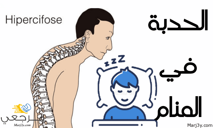 الحدبة في المنام