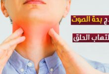 اسم دواء لعلاج بحة الصوت