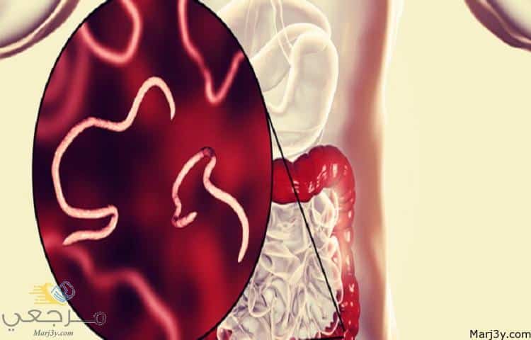 دواء لعلاج الديدان عند الكبار