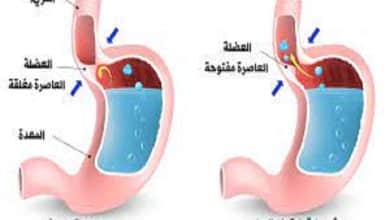 دواء لارتجاع المرئ