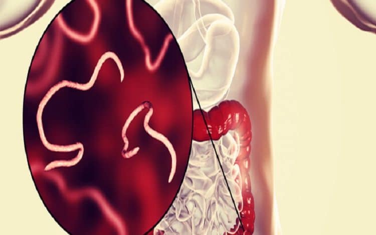 دواء لعلاج الديدان عند الكبار